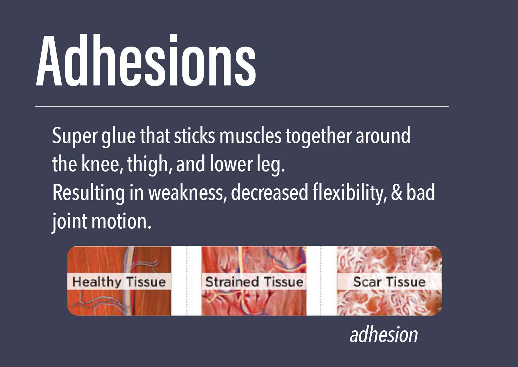 knee pain adhesions