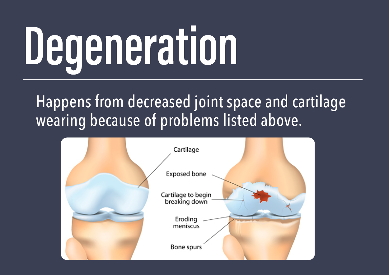knee pain 6 degeneration